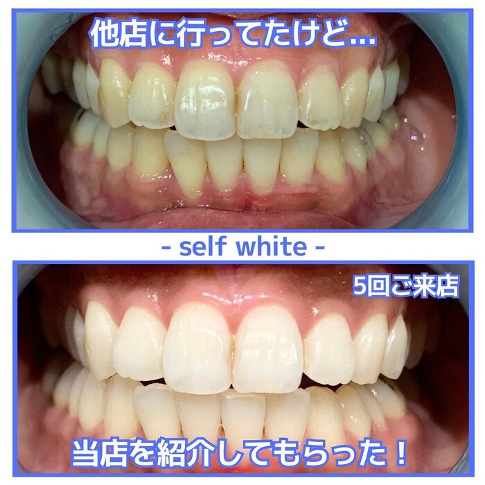 画像1043