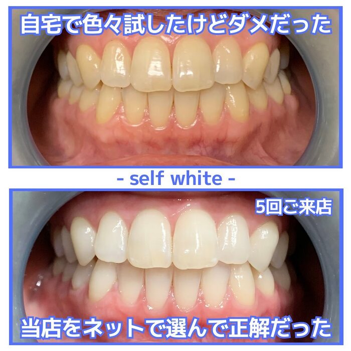 画像1085