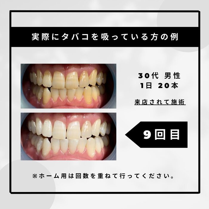画像1121