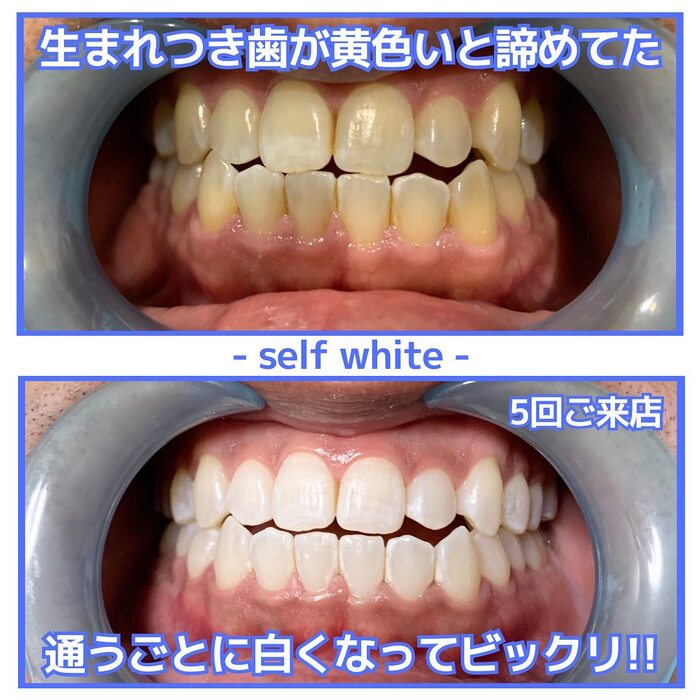 画像1128