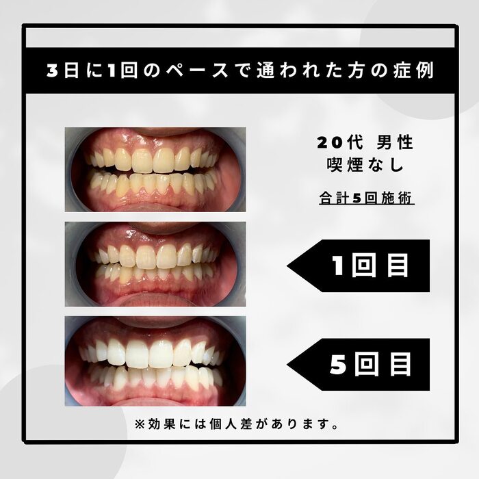 画像1143