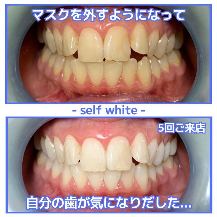 画像1150