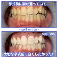 画像1195