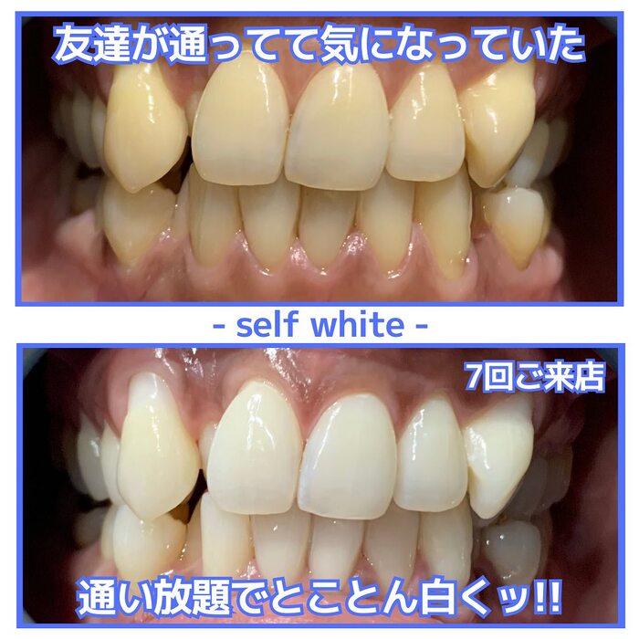 画像1245