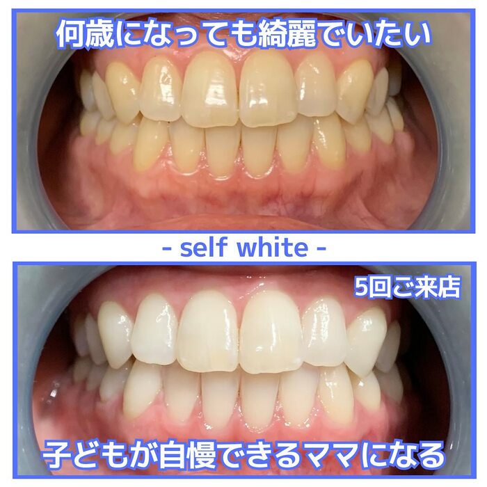 画像1294