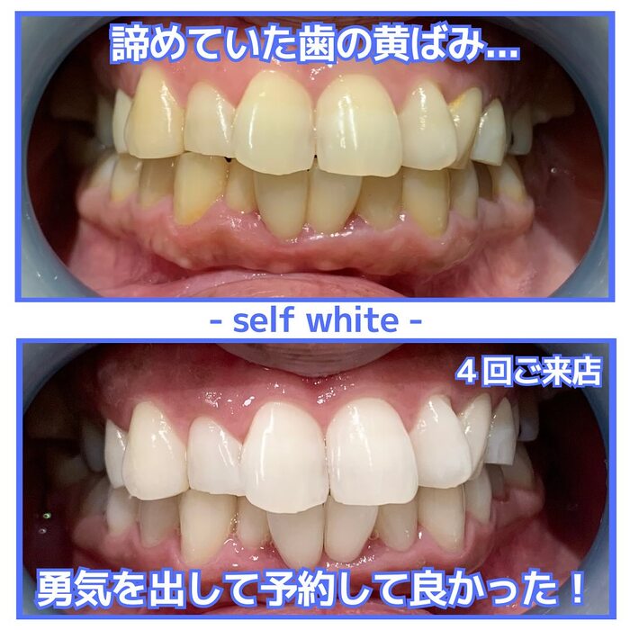 画像1328