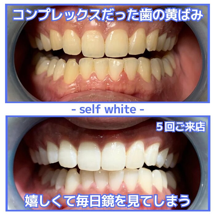 画像1353