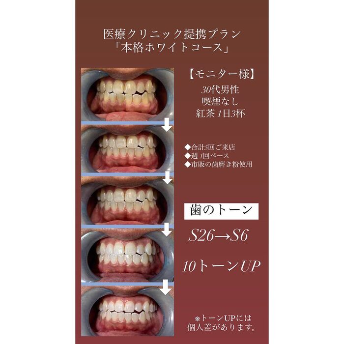 画像251