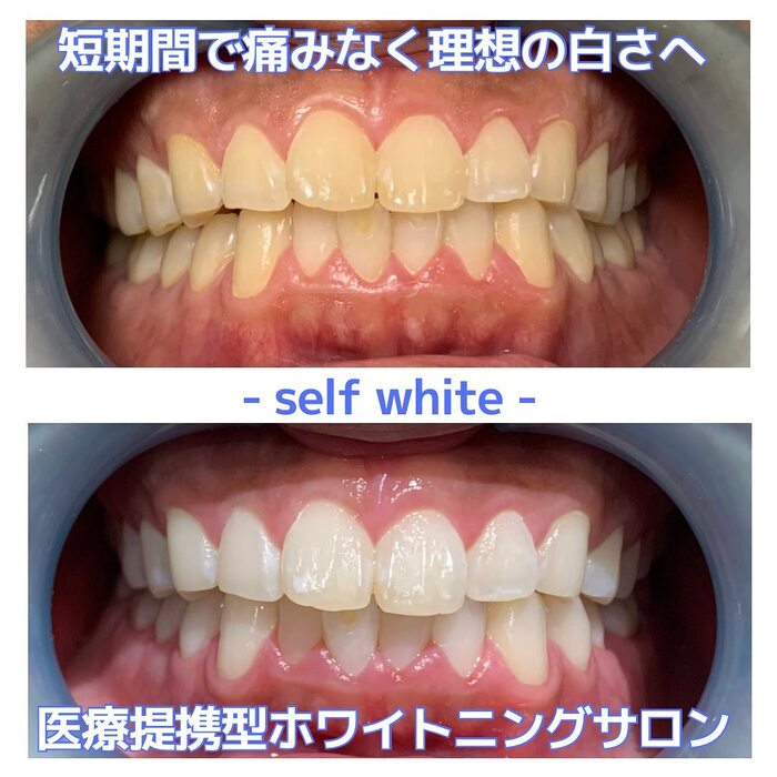 画像343