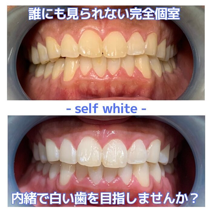 画像344