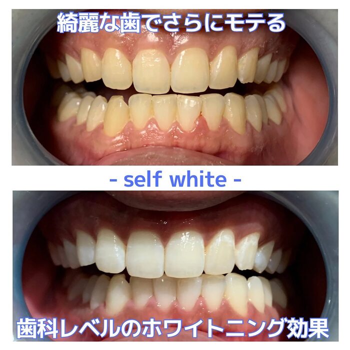 画像352