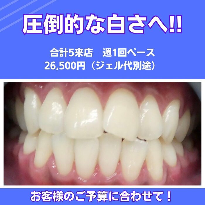 画像356