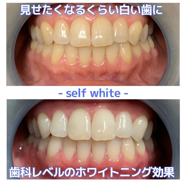 画像361