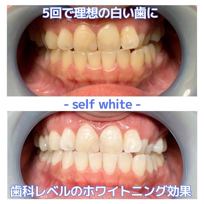 画像370