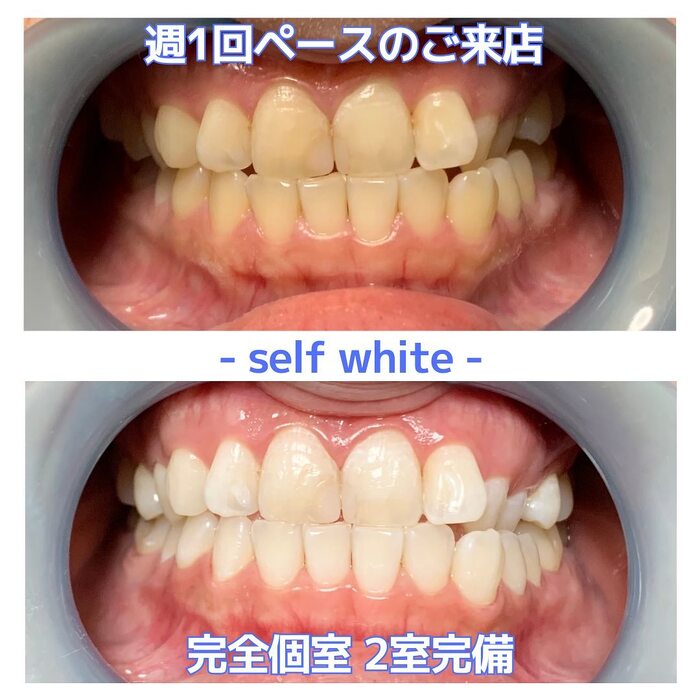 画像371