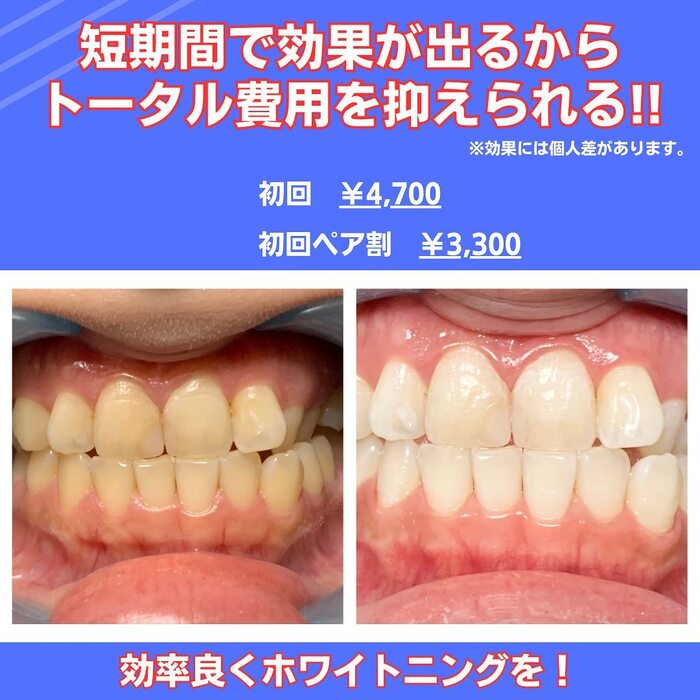 画像374
