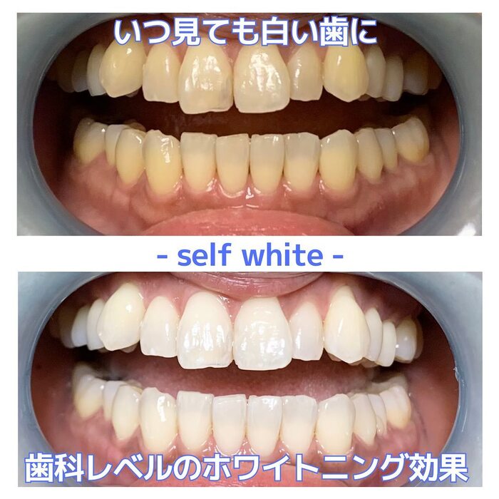 画像379
