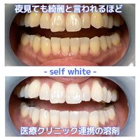 画像380