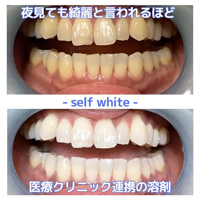 画像380