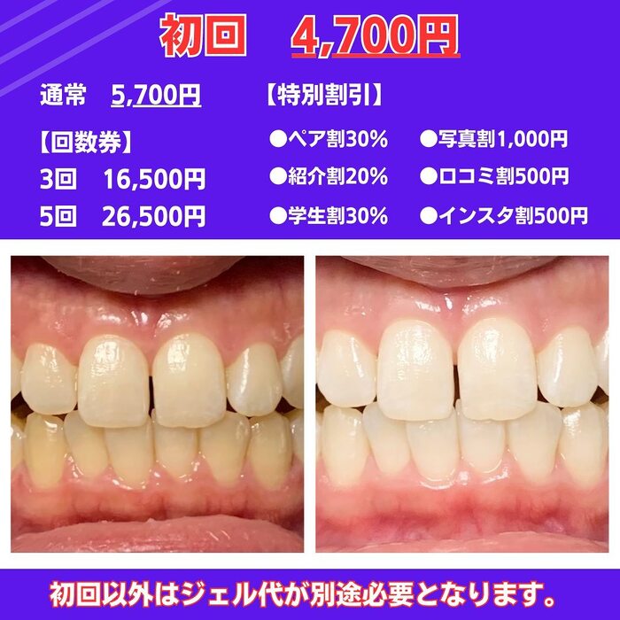 画像392