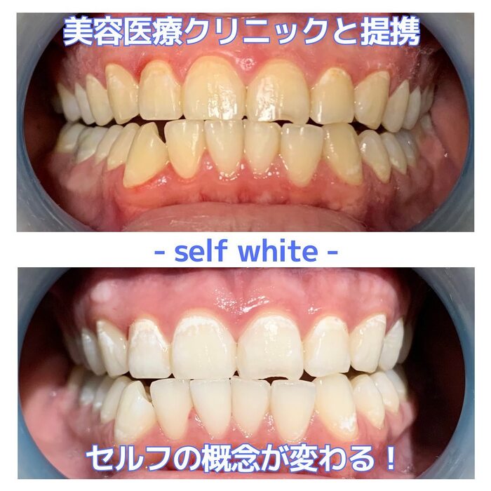 画像415