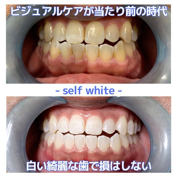 画像423