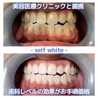 画像424