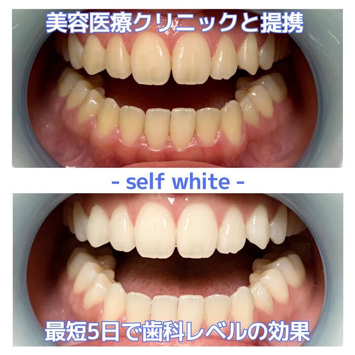 画像433