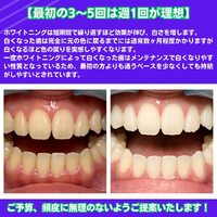 画像436