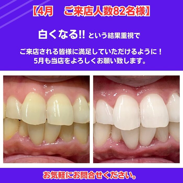 画像445