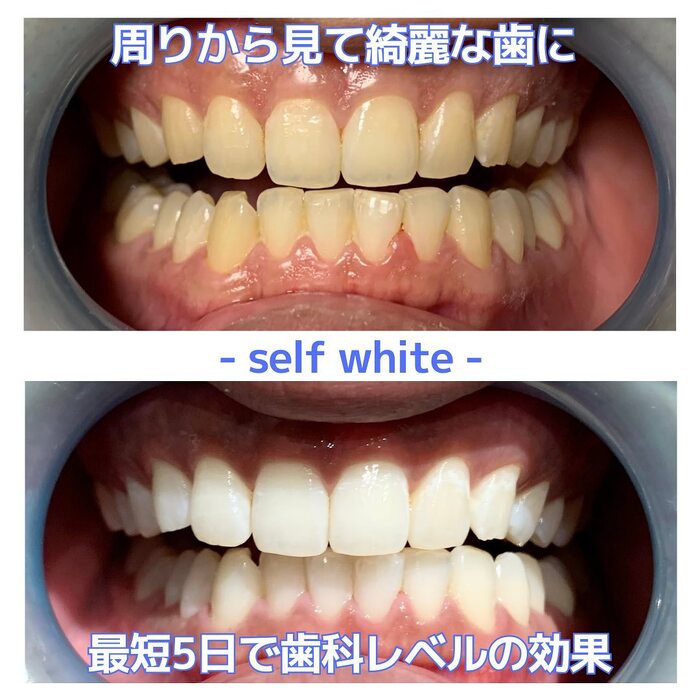 画像451