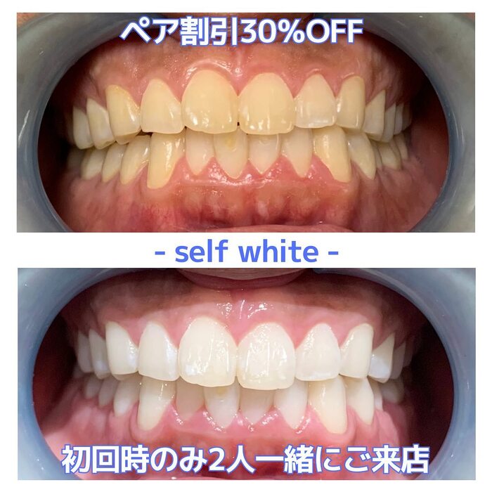 画像460