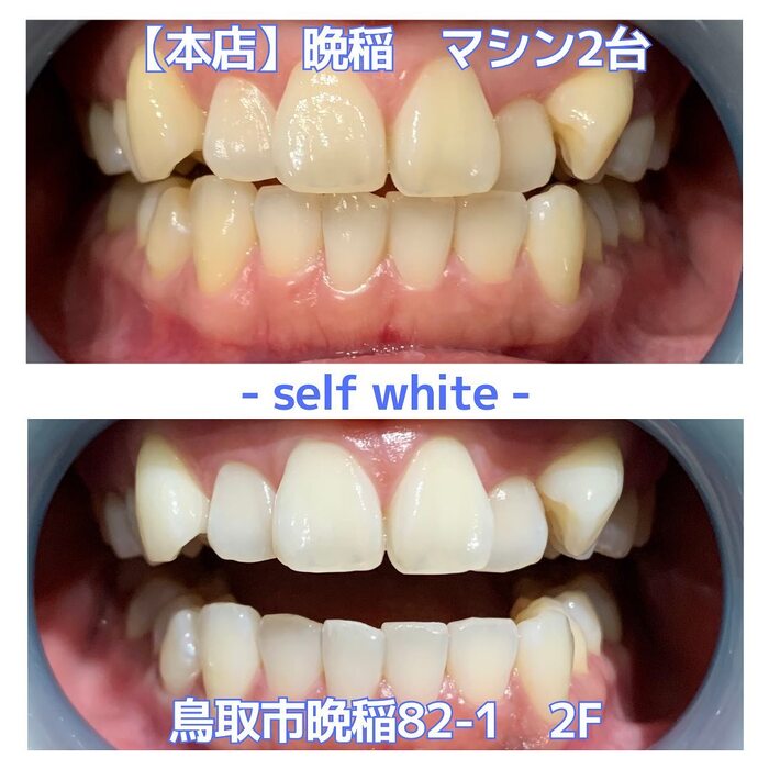 画像477
