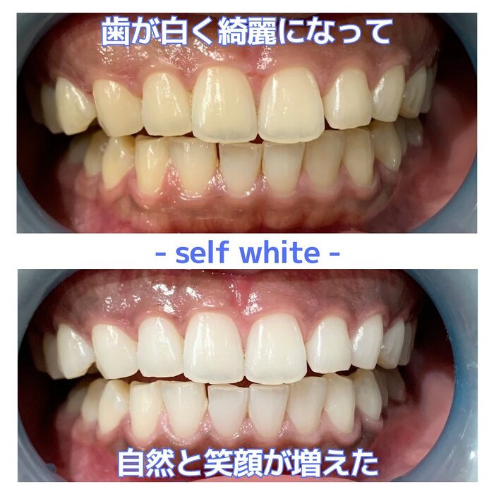 画像486