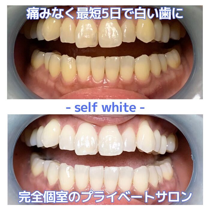 画像495