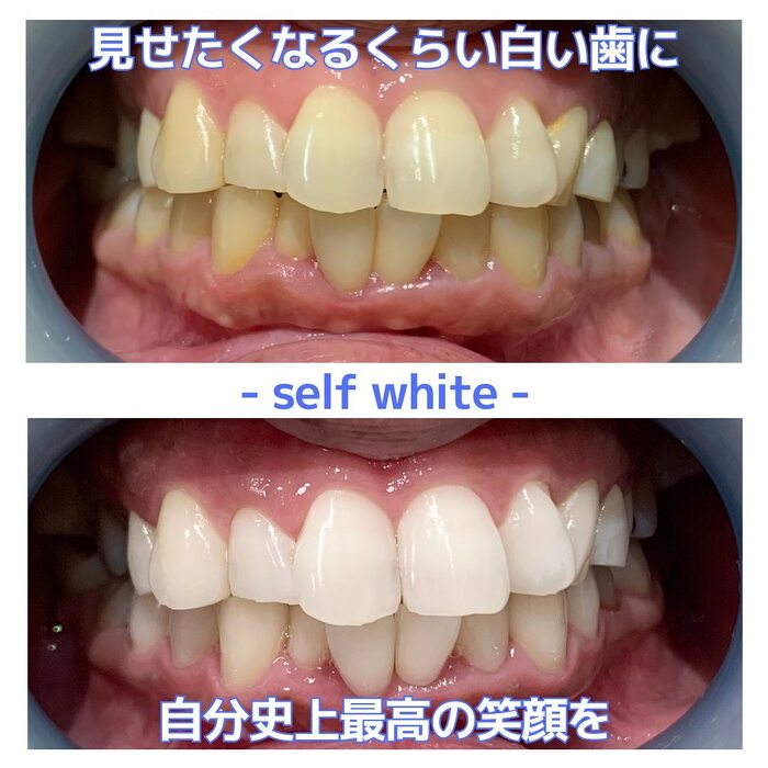 画像504