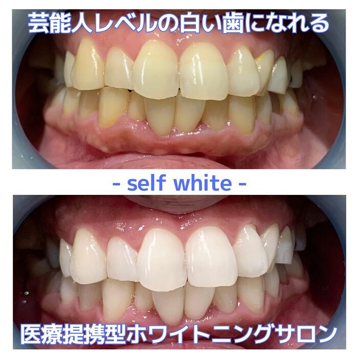 画像505