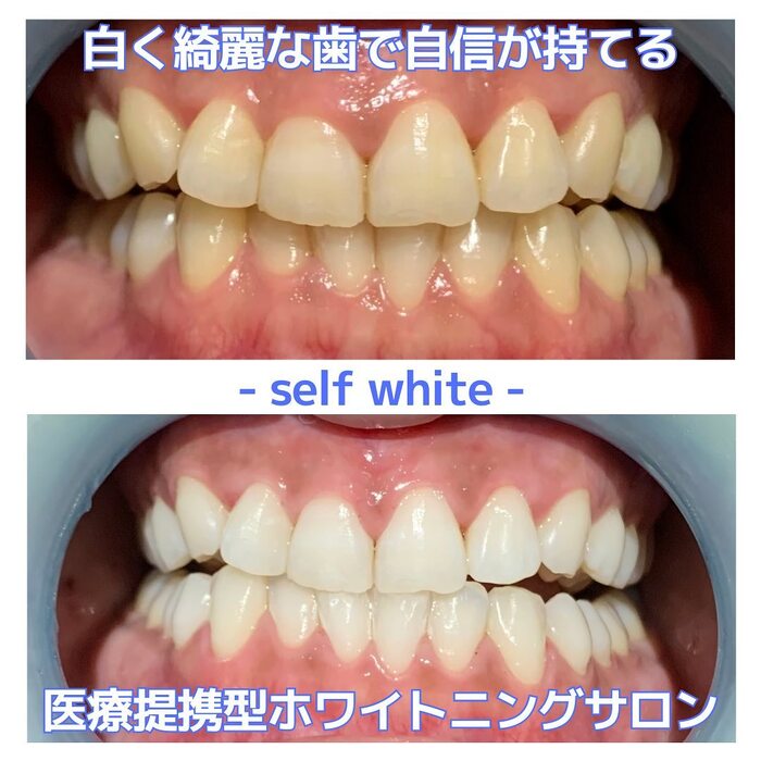 画像515