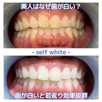 画像532