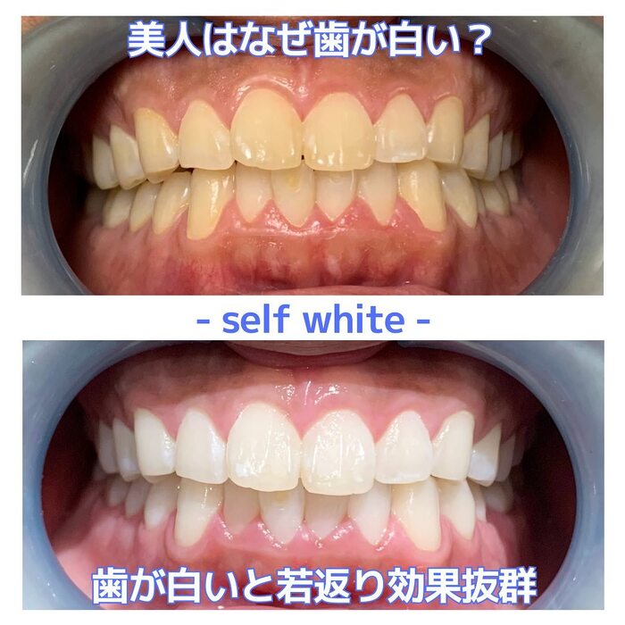 画像532