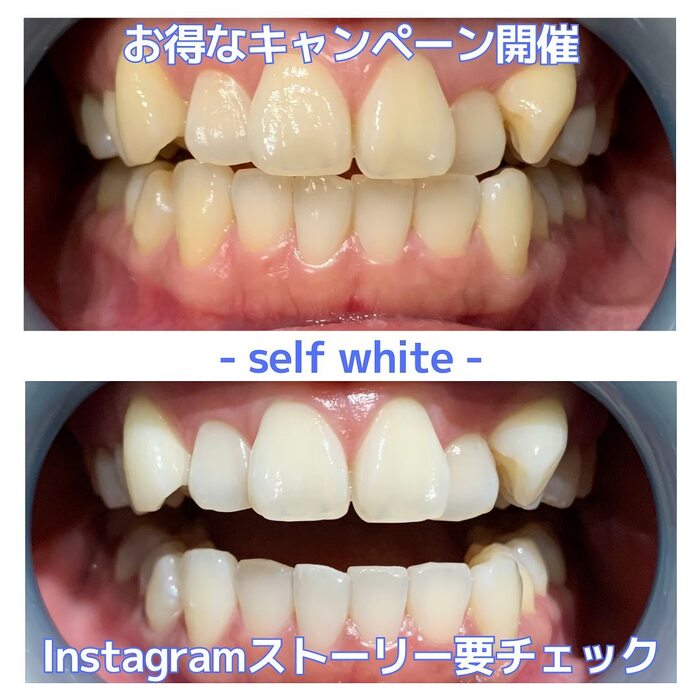 画像559