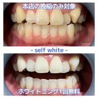 画像560