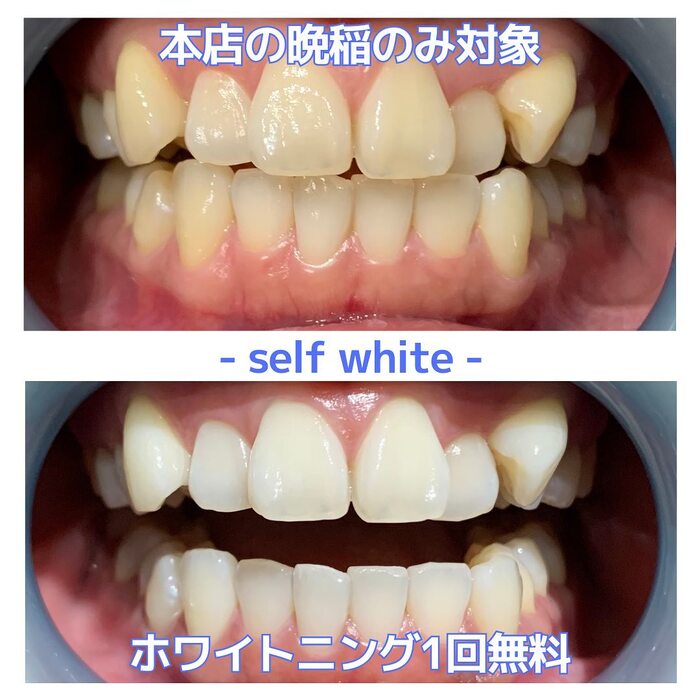 画像560