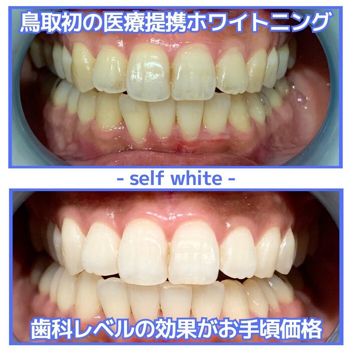 画像581