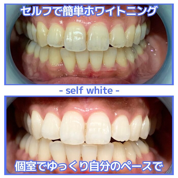 画像582