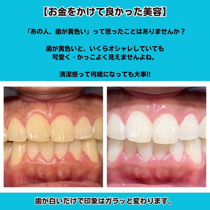 画像586