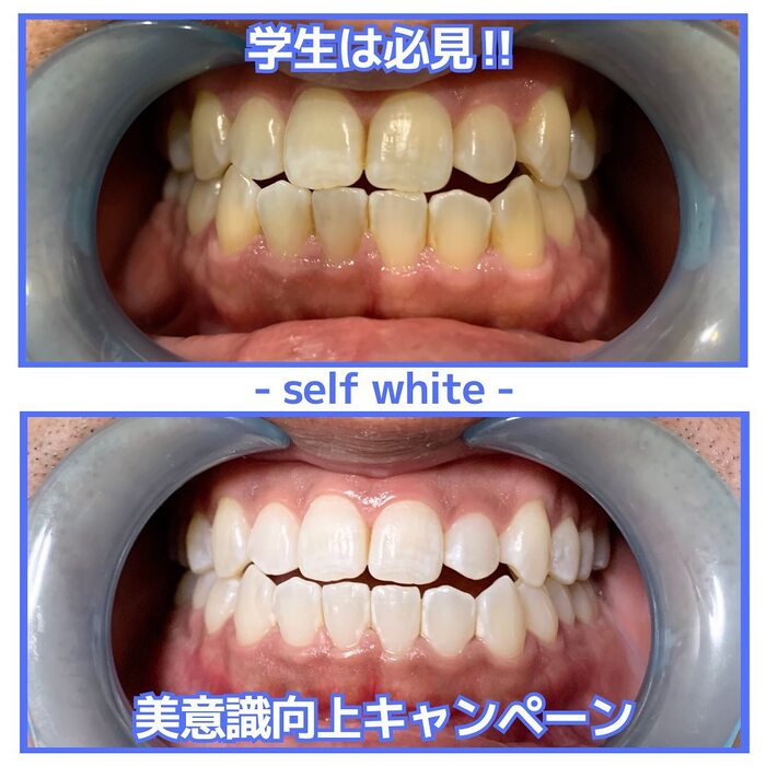 画像611