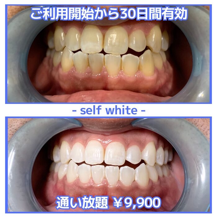 画像612