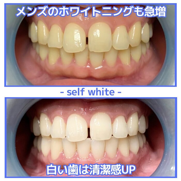 画像641