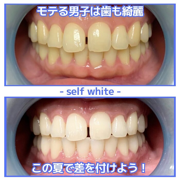 画像642